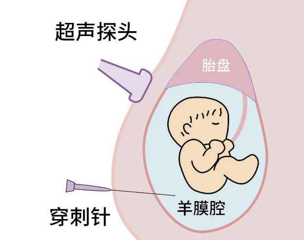 <b>广州世纪助孕生殖中心怎么样_上海世纪助孕招聘,重庆试管代怀代怀产子 影响重</b>